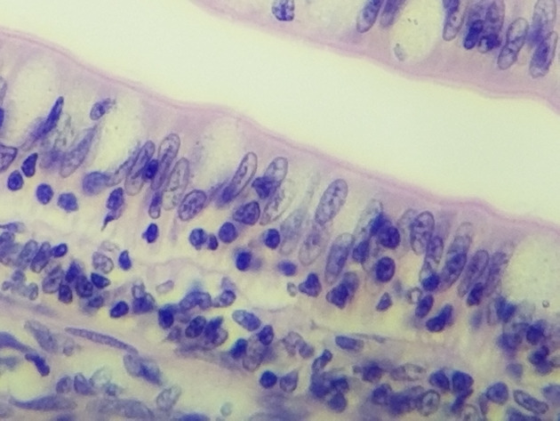 Simple Columnar Epithelium Slides - Simple Columnar Epithelium 16 400X